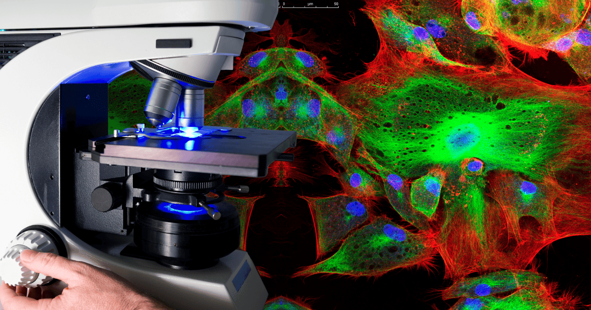 Fluorescence Microscopy
